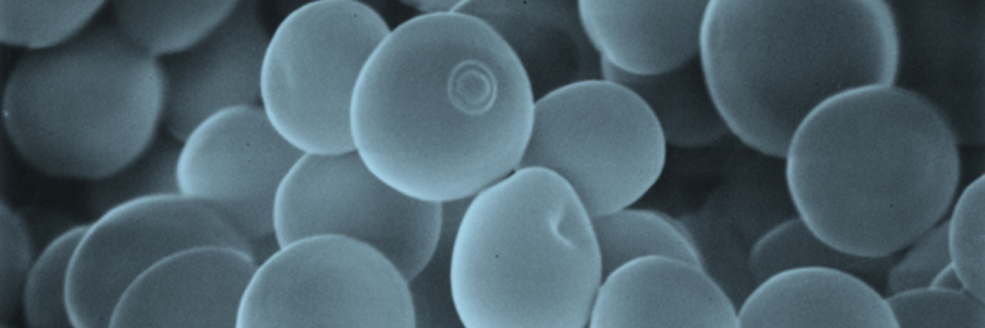 "Heisei Miyazaki Yeast" developed by the Miyazaki Prefecture Food Development Center