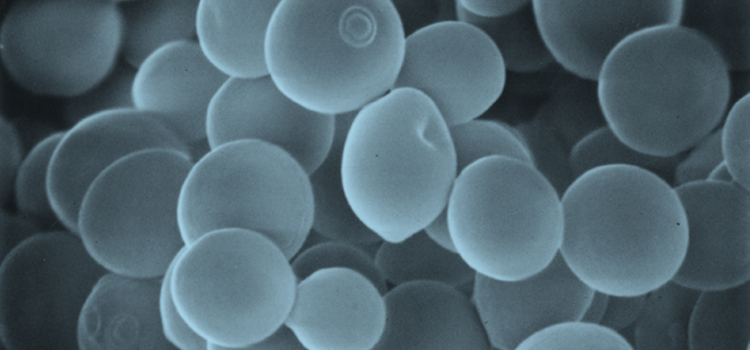 "Heisei Miyazaki Yeast" developed by the Miyazaki Prefecture Food Development Center